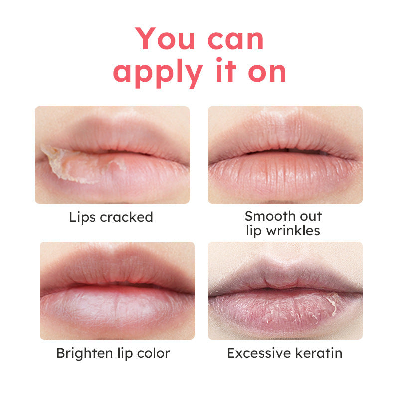 Anti-chapping Lip Care Lip Balm